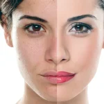 قیمت و خرید کرم معجزه شب اصلی ضدلک و سفیدکننده بیکینی و تمام نواحی پوست بدن بسیار قوی | کرم معجزه دستساز و خانگی | کرم معجزه شب بدن
