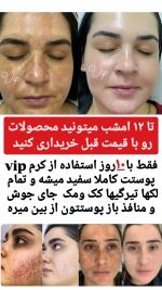 قیمت و خرید کرم معجزه شب اصلی ضدلک و سفیدکننده بیکینی و تمام نواحی پوست بدن بسیار قوی | کرم معجزه دستساز و خانگی | کرم معجزه شب بدن - Image 37