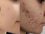 قیمت و خرید کرم معجزه شب اصلی ضدلک و سفیدکننده بیکینی و تمام نواحی پوست بدن بسیار قوی | کرم معجزه دستساز و خانگی | کرم معجزه شب بدن - Image 42