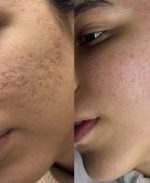 قیمت و خرید کرم معجزه شب اصلی ضدلک و سفیدکننده بیکینی و تمام نواحی پوست بدن بسیار قوی | کرم معجزه دستساز و خانگی | کرم معجزه شب بدن - Image 41