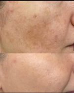 قیمت و خرید کرم معجزه شب اصلی ضدلک و سفیدکننده بیکینی و تمام نواحی پوست بدن بسیار قوی | کرم معجزه دستساز و خانگی | کرم معجزه شب بدن - Image 40